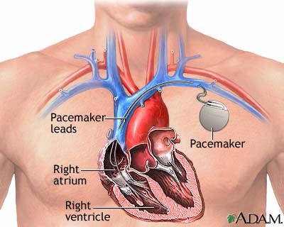 Blood flow through the heart diagram for kids